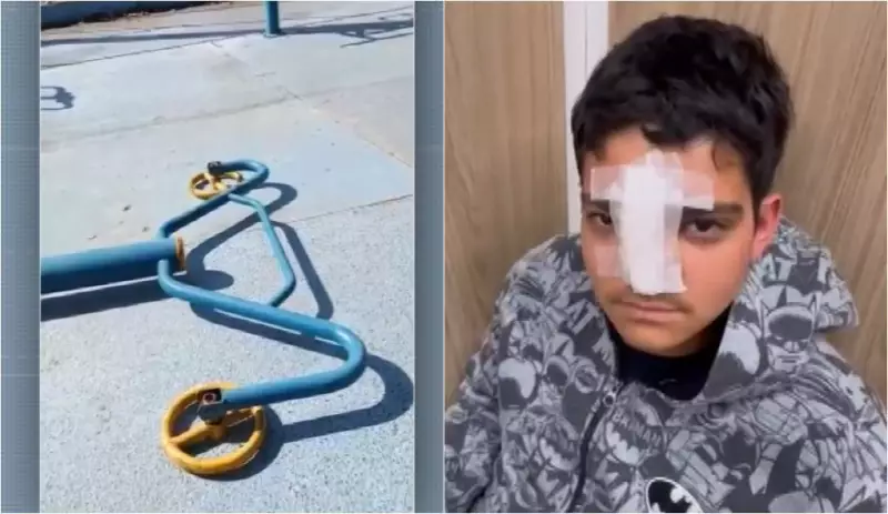 Acidente em academia ao ar livre: adolescente tem ossos da face fraturados em Campinas