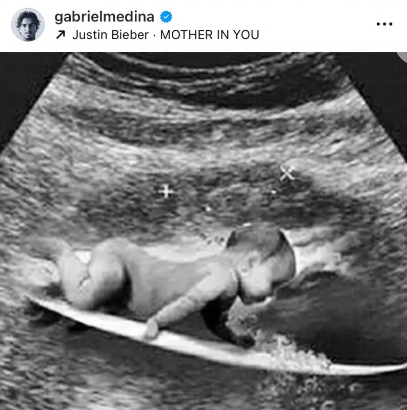 Aparelho de Ultrassom é Furtado de Hospital Municipal em Medina: Obra Paralisada e Prejuízo à População