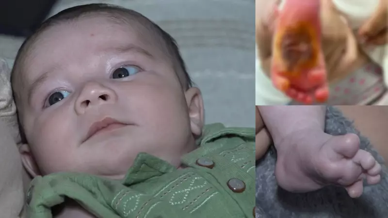 Bebê supera queimadura grave no pé após 36 dias internado em hospital do ES: 'Milagre em casa'