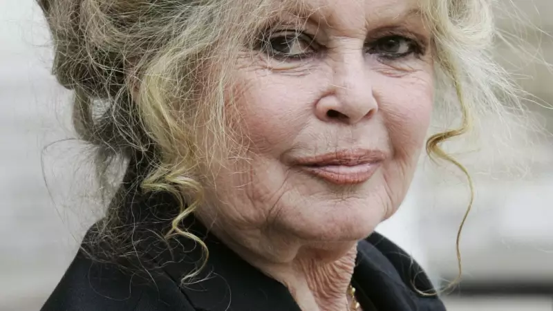 Brigitte Bardot passa por cirurgia com sucesso e já está em casa se recuperando