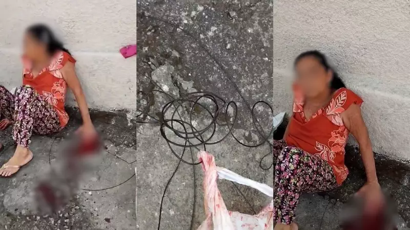 Fios Soltos em Divinópolis: Idosa Perde Dedos em Acidente Chocante e Família Revela Falta de Reimplante