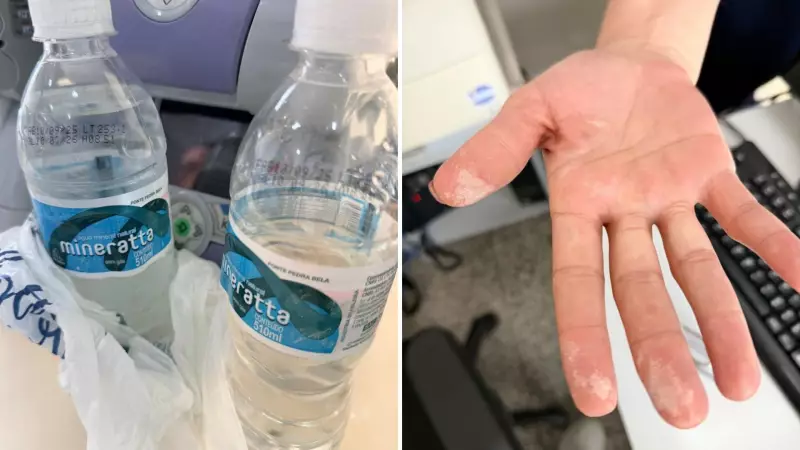 Intoxicação por Água em SP: Caso Assusta Interior Paulista e Revela Perigo Oculto