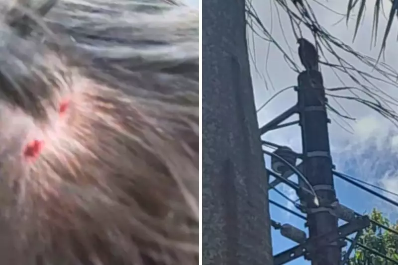 Jovem de 17 anos é atacado por gavião na cabeça em Santos; assista ao vídeo impressionante