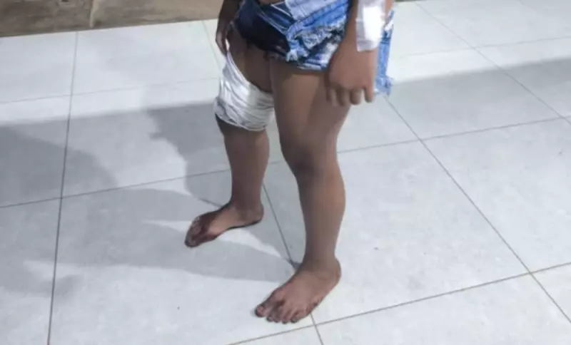 Jovem de 17 anos é esfaqueada após esbarrar em mulher durante festa em Minas Gerais