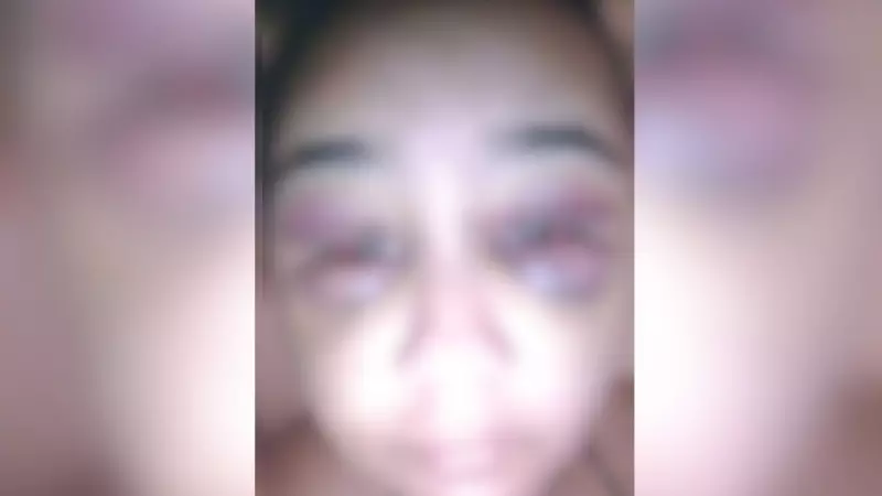 Jovem sofre agressão brutal do ex-namorado por quase 2 horas em MG: 'Pensei que ia morrer'