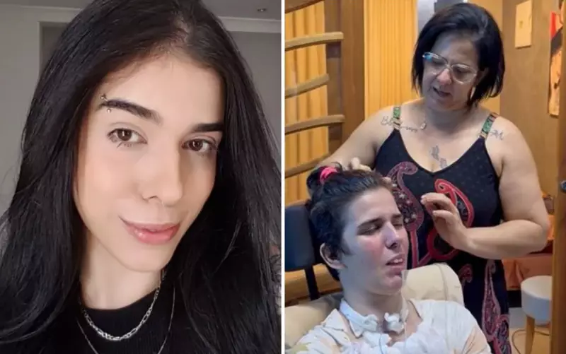 Jovem tem reação grave após cheirar pimenta: mãe revela desafios na recuperação zero