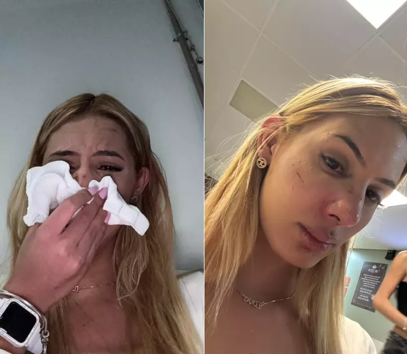 Jovem trans sofre agressão transfóbica com soco no nariz em cidade do interior de SP