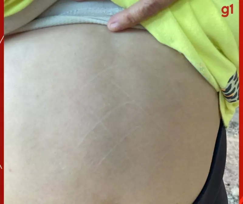 Marido é preso após desenhar 'jogo da velha' com faca na barriga da esposa em MT