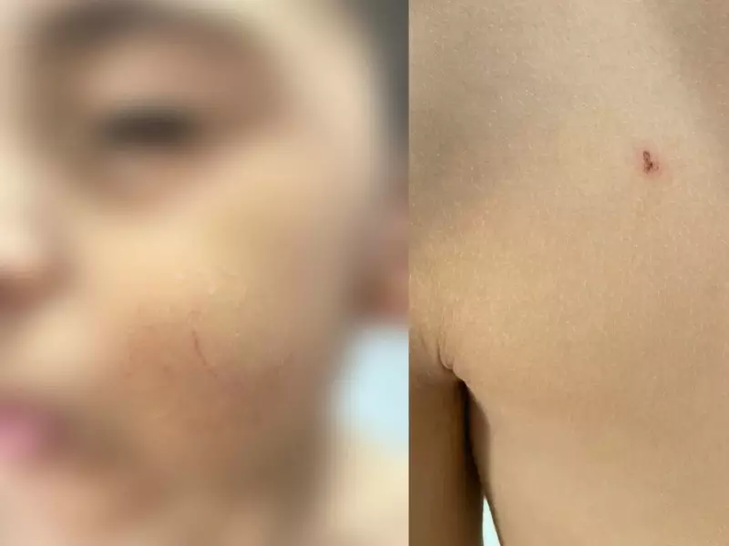 Mãe relata trauma: criança de 4 anos teria sido forçada a tomar banho durante crise em escola do Acre