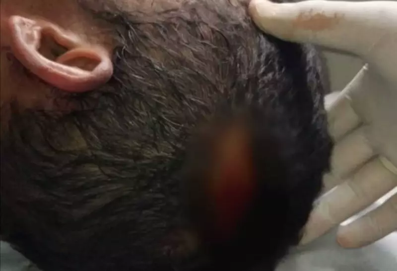 Pedreiro é atacado a facadas durante obra em Minas Gerais; suspeito preso em flagrante