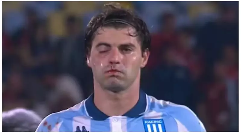 Quase nocaute! Companheiro de time acerta golpe acidental em Sosa durante comemoração no Racing