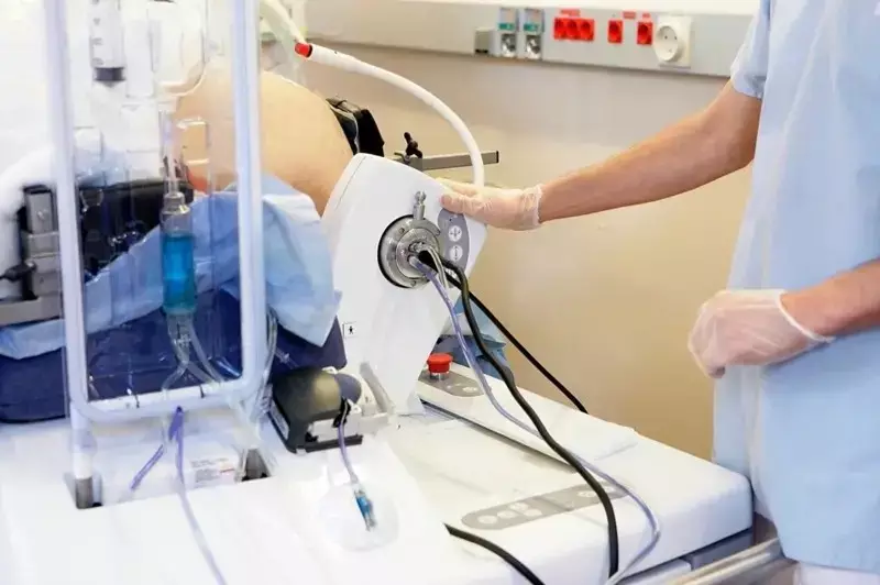 Ultrassom Revoluciona Tratamento do Câncer: Nova Técmina Elimina Necessidade de Cirurgias