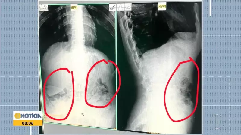 Vale do Aço em Alerta: Temporal Provoca Destruição e Deixa Rastro de Prejuízos