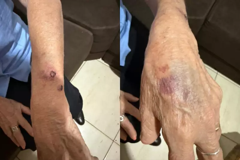 Vizinho Salva Idosa de Maus-Tratos: Filha é Presa Após Gritos de Socorro em Londrina