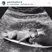 Aparelho de Ultrassom é Furtado de Hospital Municipal em Medina: Obra Paralisada e Prejuízo à População