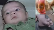 Bebê supera queimadura grave no pé após 36 dias internado em hospital do ES: 'Milagre em casa'