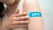 HPV: Unimed Cuiabá Alerta que Vacina é Arma Poderosa na Prevenção do Câncer