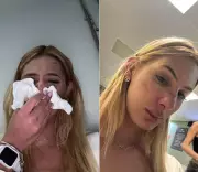 Jovem trans sofre agressão transfóbica com soco no nariz em cidade do interior de SP