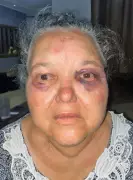 Tragédia no Chapadão: Idosa de 72 anos é assassinada a facadas em possível assalto