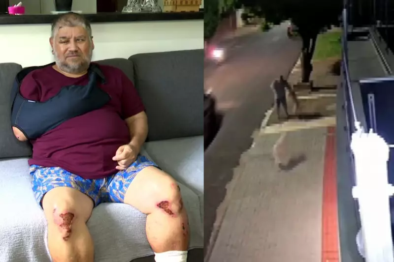 Ataque de Pitbulls no Paraná: Homem Revive Momento de Terror e Teme pela Própria Vida