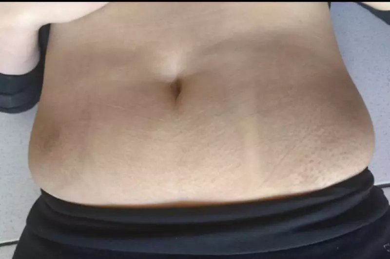 Clínica interdita após causar queimaduras graves em paciente em MS