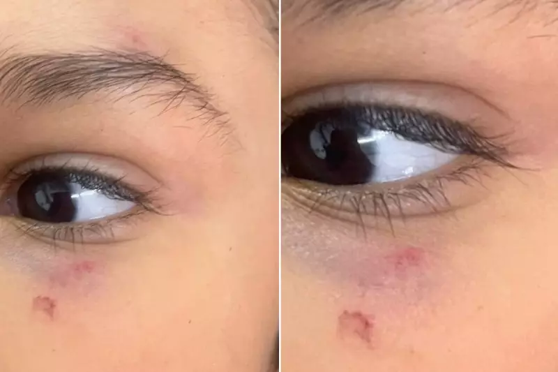 Criança de 6 anos agredida por professora com pá de lixo em escola de Praia Grande