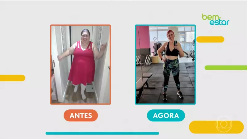 De 100kg a uma vida sem apneia: a transformação radical após cirurgia bariátrica