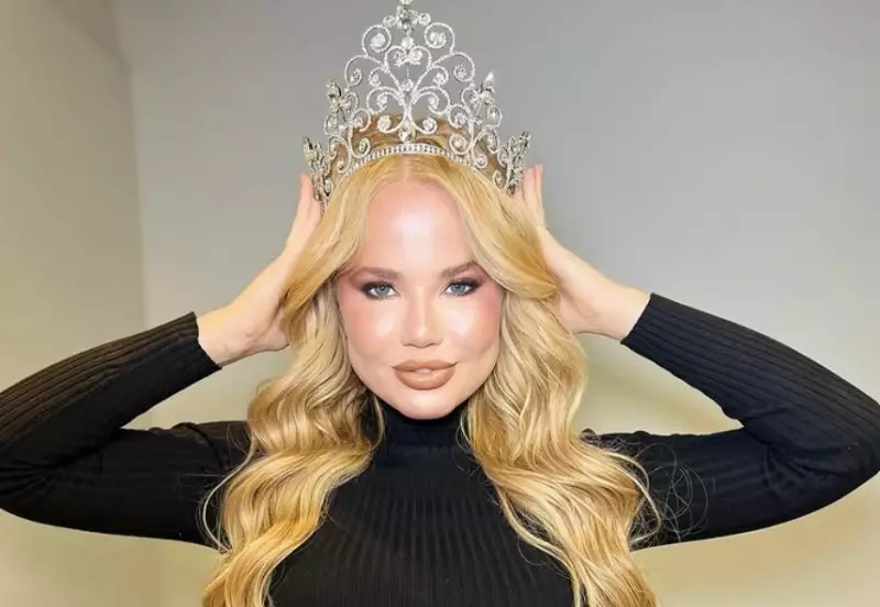 Ex-namorada de Dado Dolabella revela buscas por ajuda após agressão