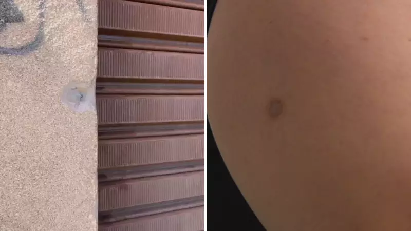 Guerra de Gangues: Jovem fica paraplégico após tiroteio em Rio Preto