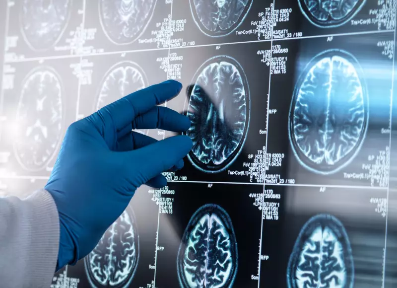 Inflamação Cerebral: Estudo Revolucionário Liderado por Brasileiros Revela Nova Peça no Quebra-Cabeça do Alzheimer