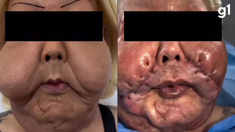 Influenciadora Juju do Pix passa por cirurgia reparadora após óleo mineral no rosto