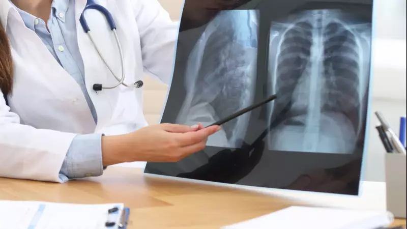 Internações por pneumonia crescem 20% em SP após pandemia