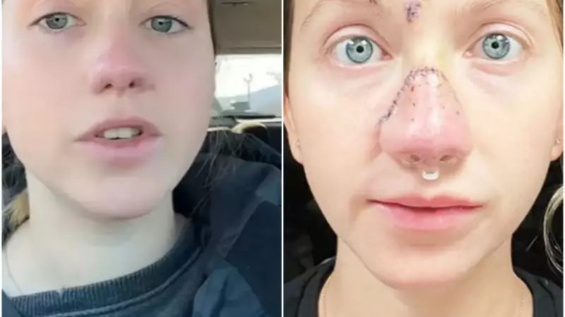 Jordan Wilson mostra rosto após 16 cirurgias por ataque de cão Boerboel