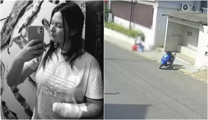 Jovem Desabafa Após Ter Mão Amputada por Ex-com Facão em SC: 'Vivo um Pesadelo'