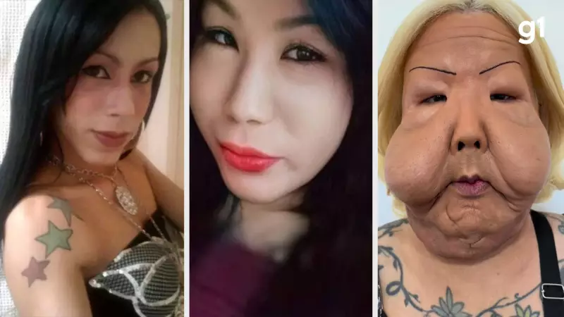 Juju do Pix: Influenciadora passa por 1ª cirurgia reparadora após óleo mineral