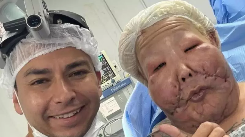 Juju do Pix passa por cirurgia reparadora após óleo mineral no rosto