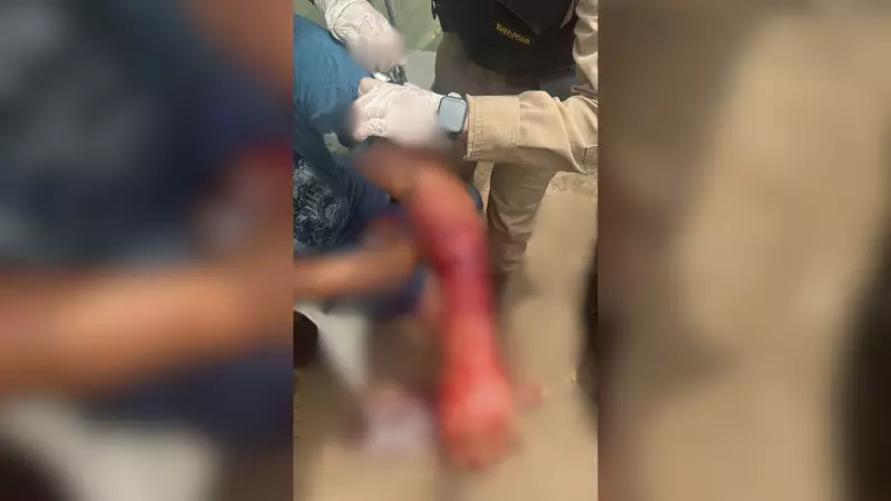 Mulher esfaqueia ex após flagrá-lo com outra em Patrocínio: drama de ciúmes termina em violência