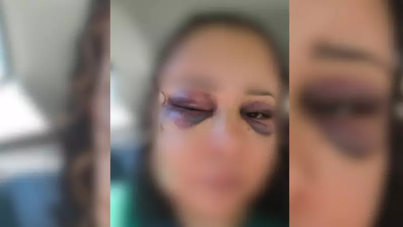 Mulher sofre fratura no nariz e maxilar após agressão em Rio Preto