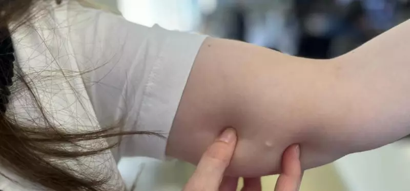 Paraná oferece implante contraceptivo pelo SUS para 25 mil mulheres