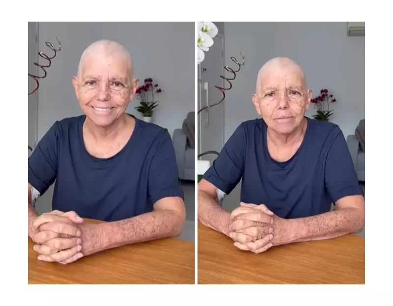 Roseana Sarney revela desafios no tratamento de câncer de mama