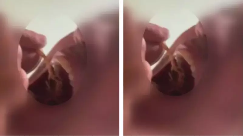 Servidores de Zoonoses colocam escorpião na boca em MG