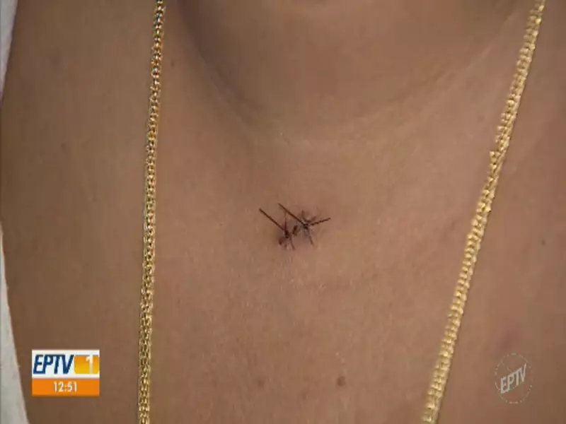 Vítima de intolerância religiosa em Mogi Mirim relata 7 facadas e perda de dedo