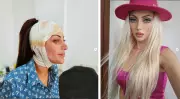 Influencer 'Barbie Humana' morre em SP após 27 cirurgias plásticas: a busca extrema pela perfeição