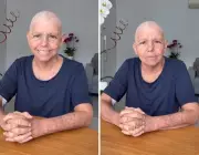 Roseana Sarney revela desafios no tratamento de câncer de mama