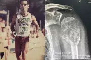 Triatleta com 57 maratonas enfrenta câncer de próstata metastático