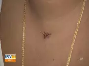 Vítima de intolerância religiosa em Mogi Mirim relata 7 facadas e perda de dedo