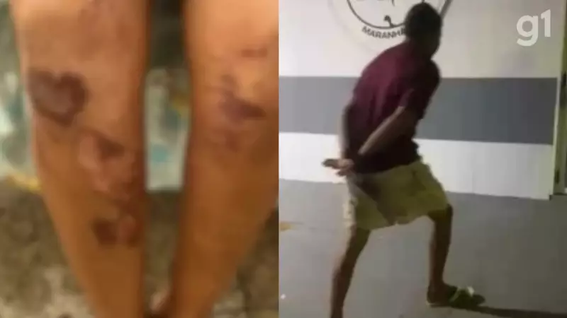 Agressor com histórico de estupro é detido após ataque violento no Maranhão