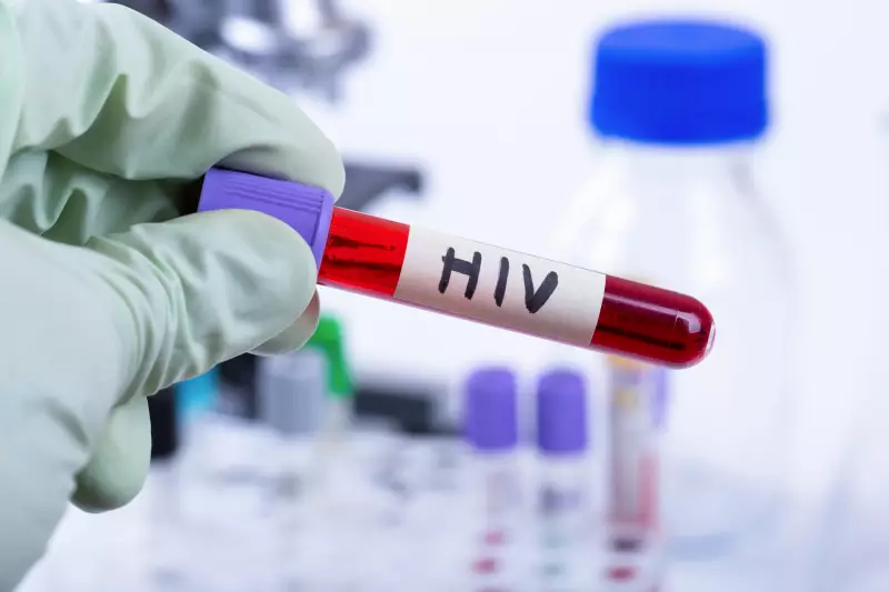Brasil tem queda na aids e mortalidade, mas casos de HIV sobem levemente