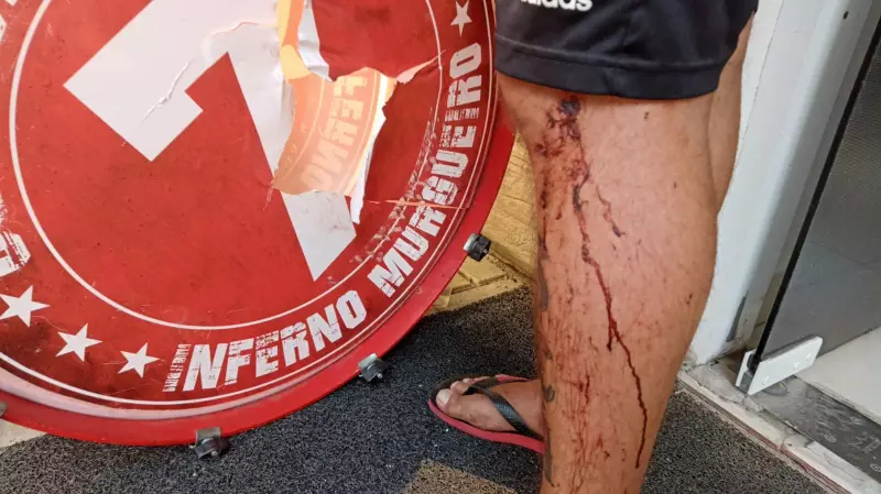 Briga de torcidas fecha BR-101 em SC: 10 presos e 6 feridos em ataque a ônibus