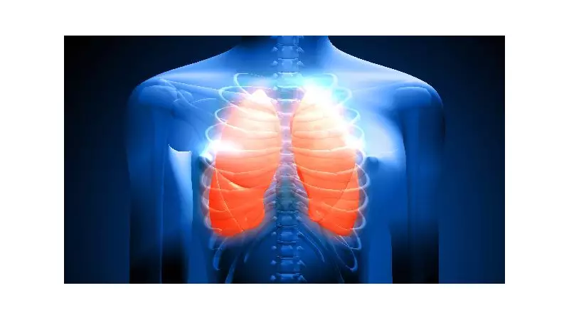 Câncer de pulmão muda perfil: 10% dos casos agora são em jovens, diz IASLC